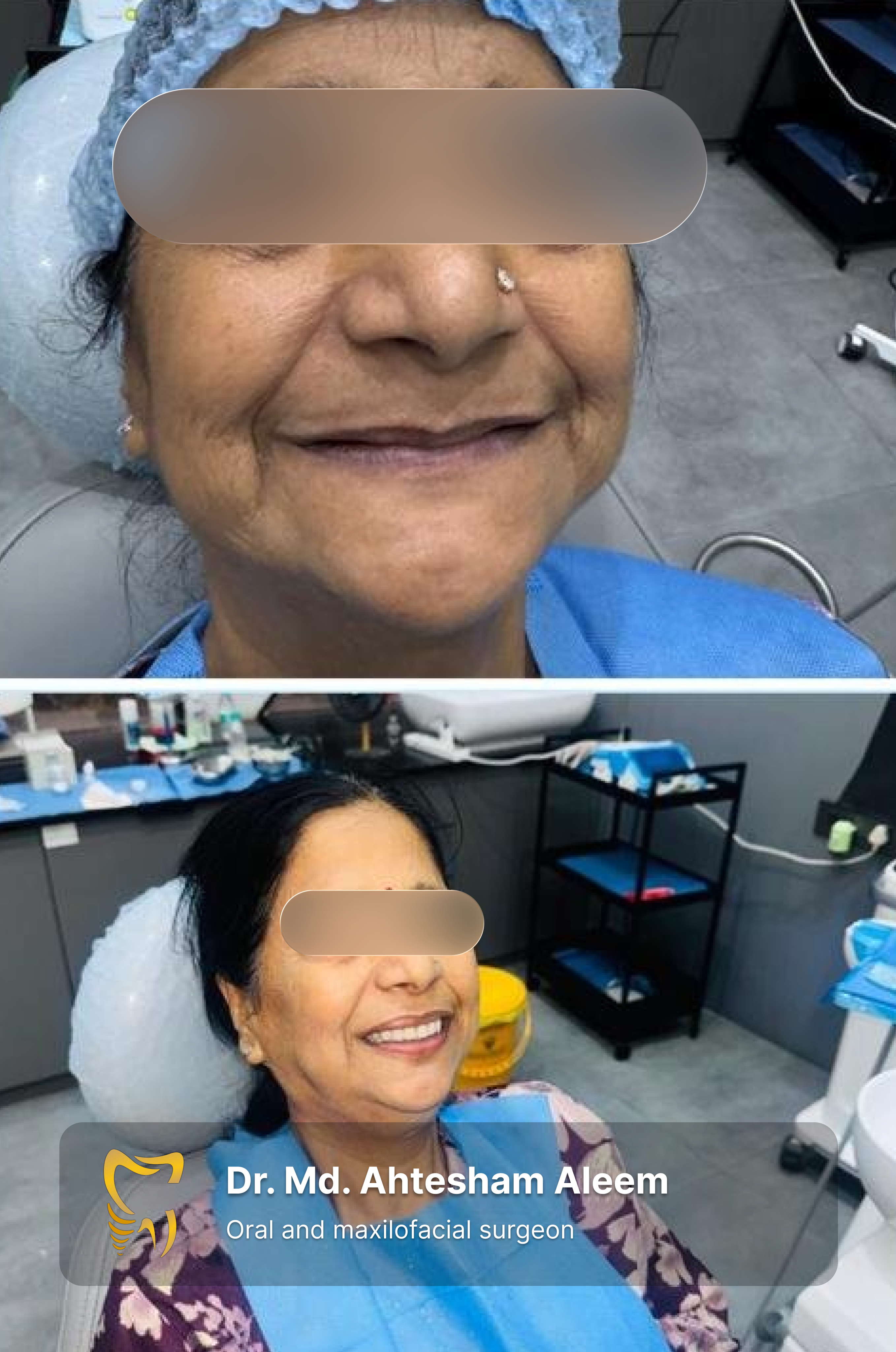 A full-arch implant rehabilitation gave this patient the ability to eat, speak and smile with confidence again.