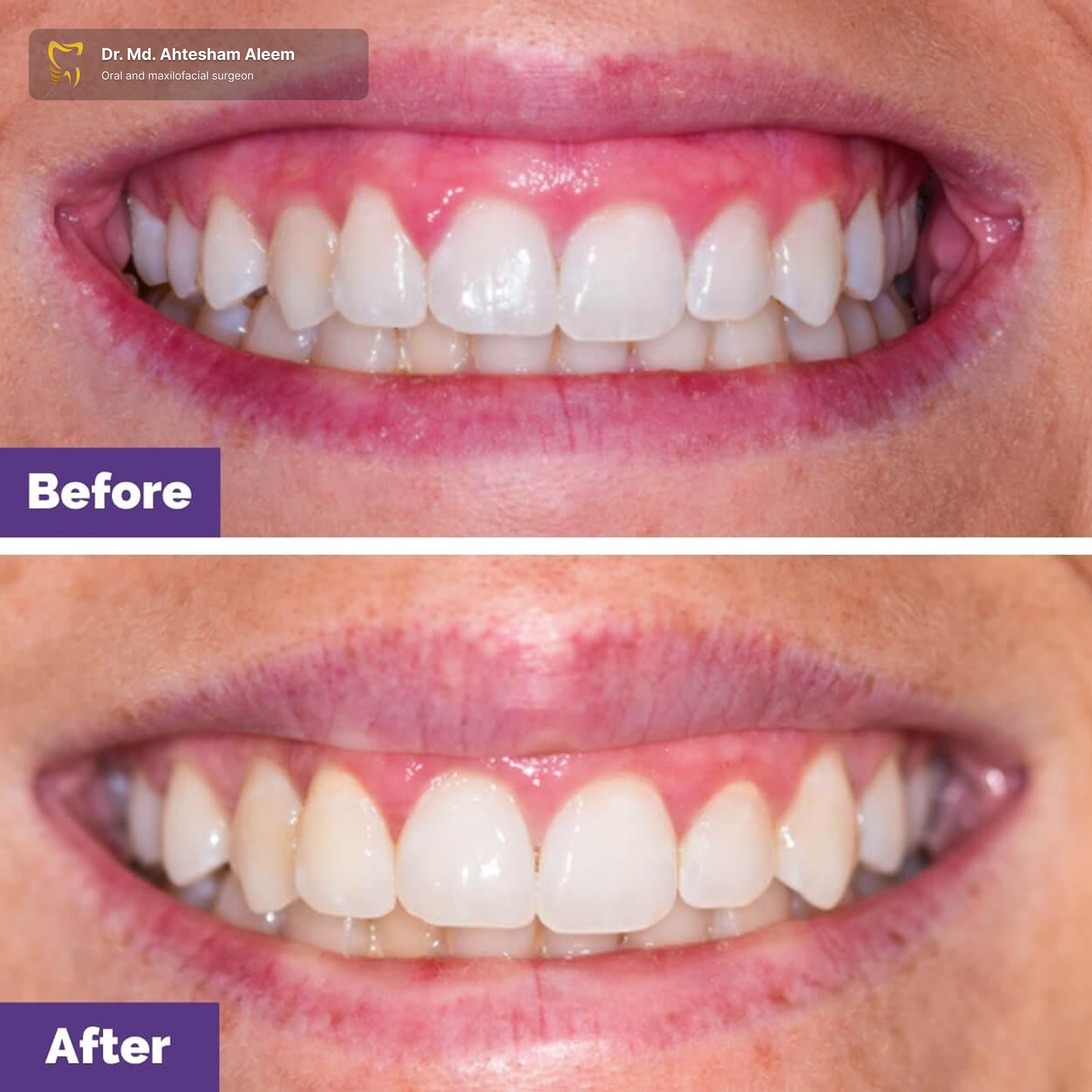 Advanced Laser Dentistry Image 1