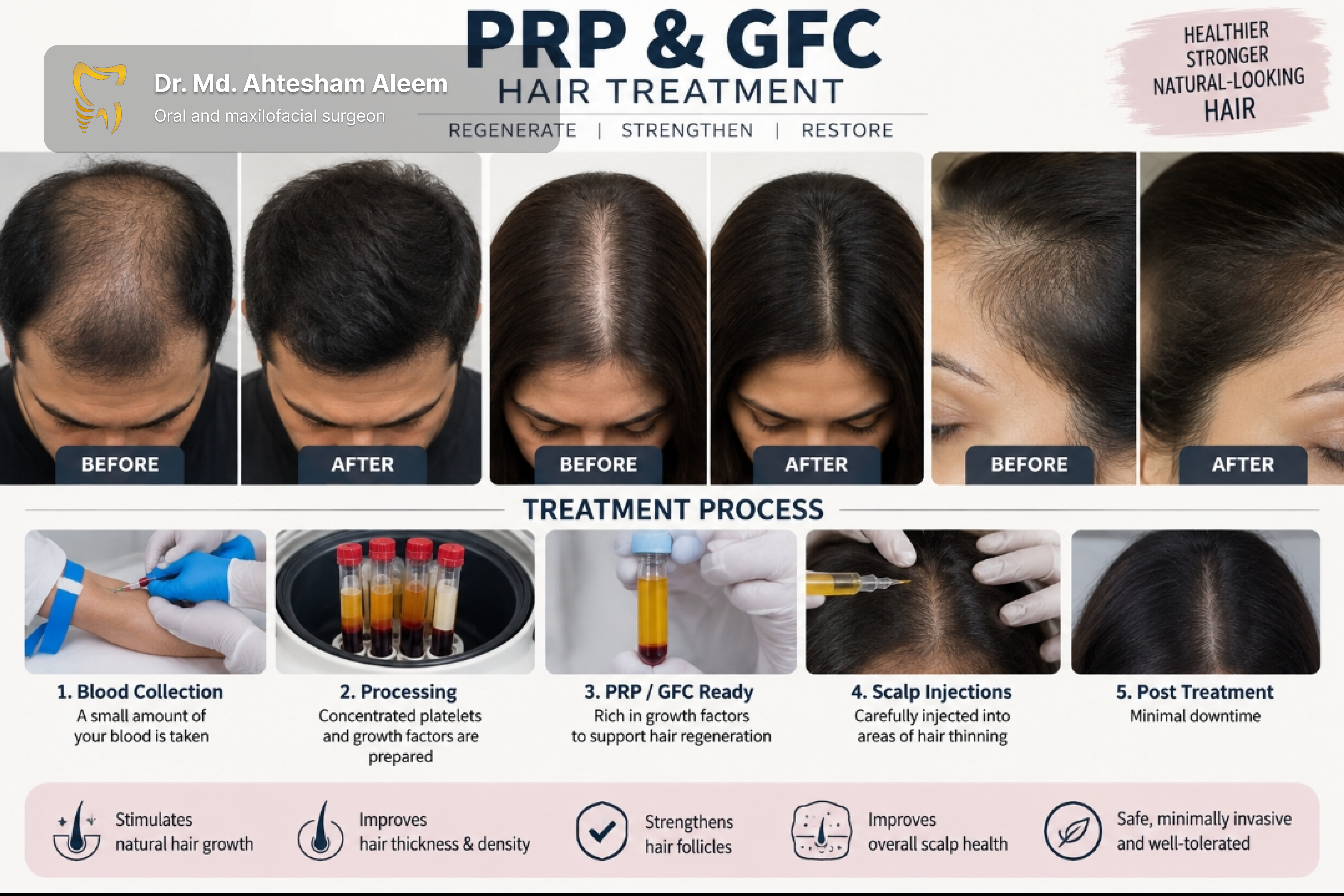 PRP & GFC Hair Treatment Image 1