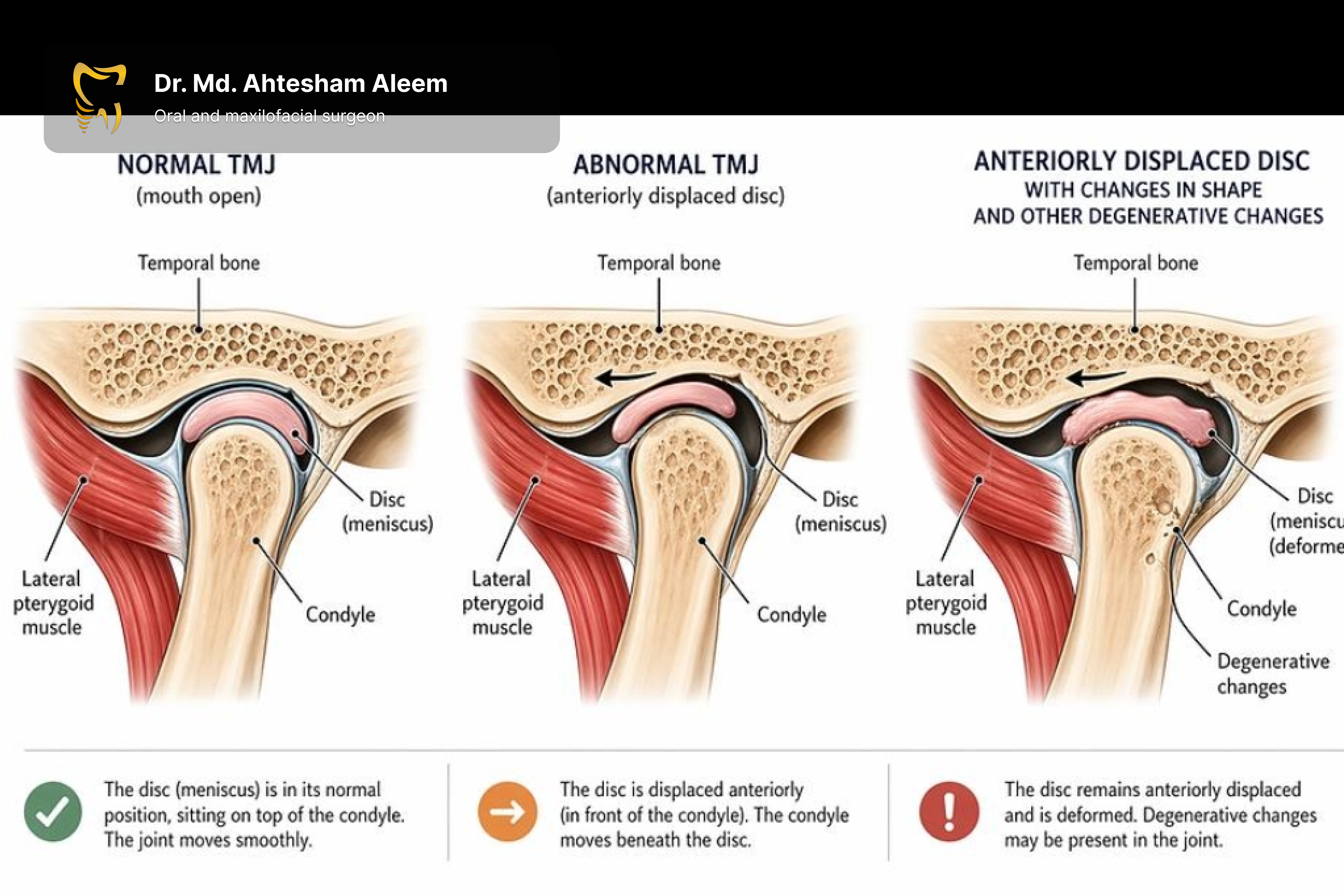 TMJ Dysfunction & Disorders Image 1